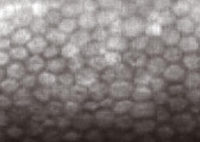 正常な角膜内内皮細胞